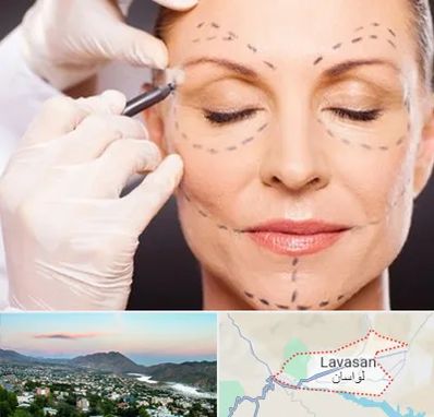 دکتر زیبایی صورت در لواسان