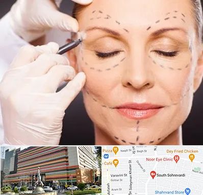 دکتر زیبایی صورت در سهروردی 