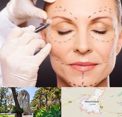 دکتر زیبایی صورت در نیشابور
