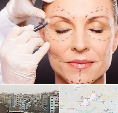دکتر زیبایی صورت در محمد شهر کرج 