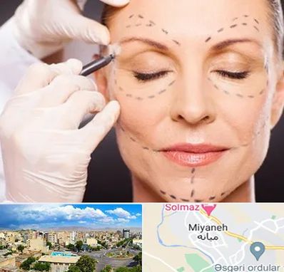 دکتر زیبایی صورت در میانه