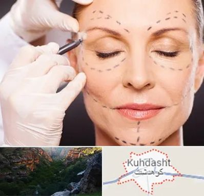 دکتر زیبایی صورت در کوهدشت