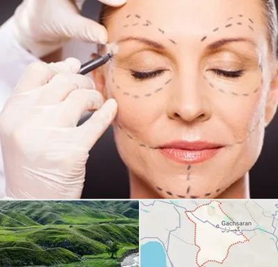 دکتر زیبایی صورت در گچساران