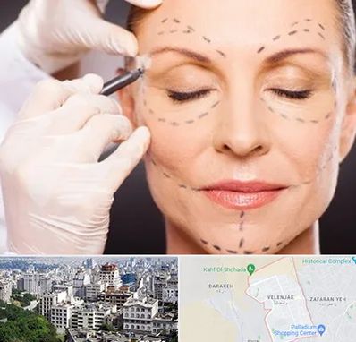 دکتر زیبایی صورت در ولنجک 