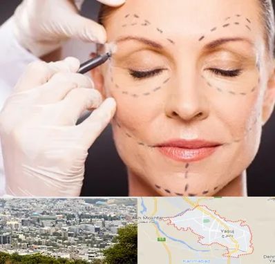دکتر زیبایی صورت در یاسوج
