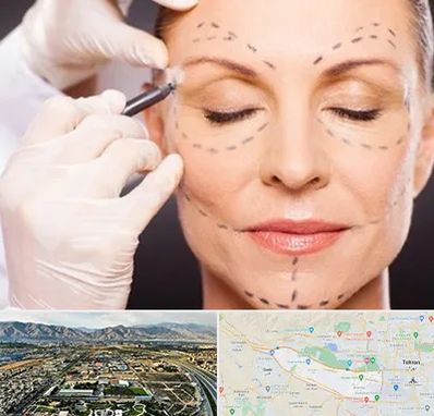 دکتر زیبایی صورت در منطقه 21 تهران 