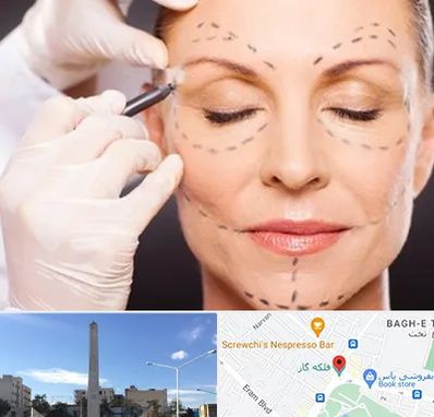 دکتر زیبایی صورت در فلکه گاز شیراز 