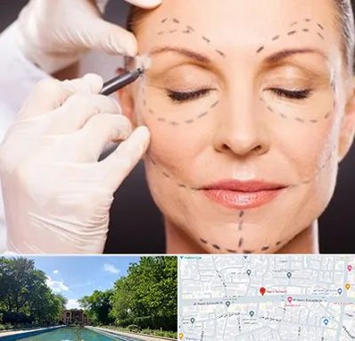 دکتر زیبایی صورت در هشت بهشت اصفهان 