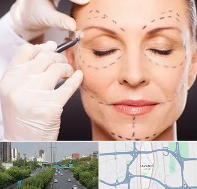 دکتر زیبایی صورت در توانیر