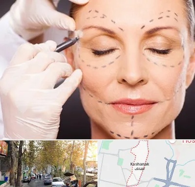 دکتر زیبایی صورت در کاشانک