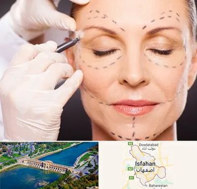 دکتر زیبایی صورت در اصفهان