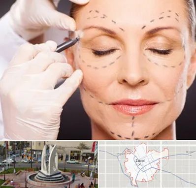 دکتر زیبایی صورت در زابل