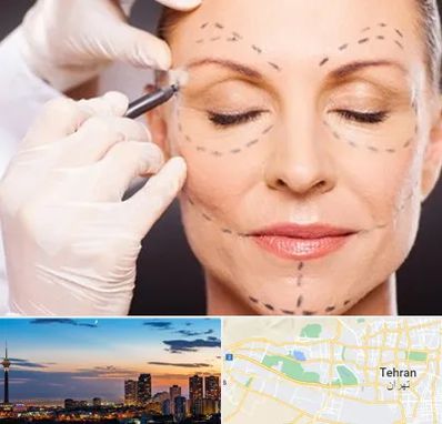 دکتر زیبایی صورت در غرب تهران 