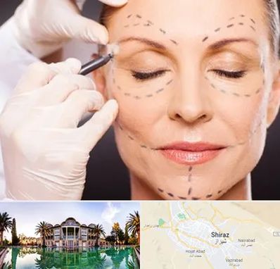 دکتر زیبایی صورت در شیراز
