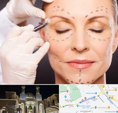 دکتر زیبایی صورت در زرگری شیراز 