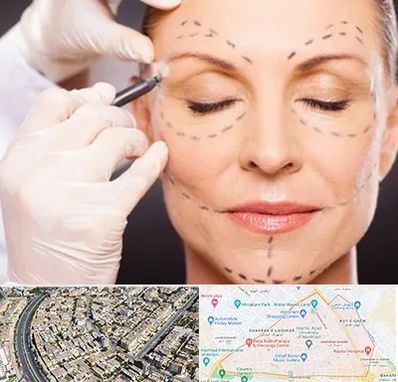 دکتر زیبایی صورت در شهرک غرب مشهد 