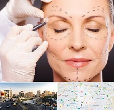 دکتر زیبایی صورت در منطقه 7 تهران 