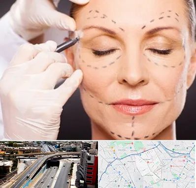 دکتر زیبایی صورت در ستارخان شیراز 