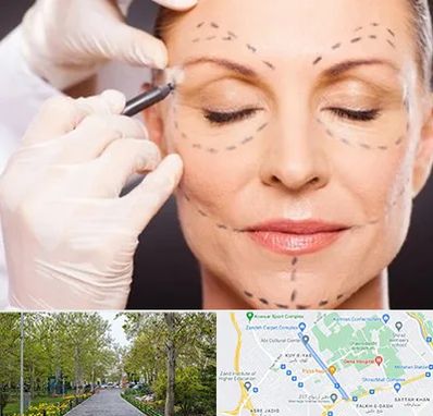 دکتر زیبایی صورت در قدوسی غربی شیراز 