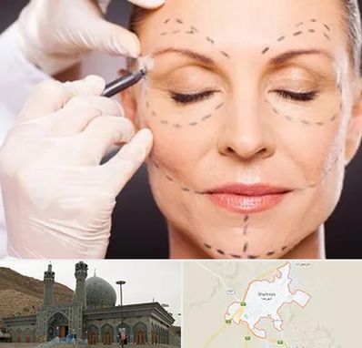 دکتر زیبایی صورت در شهرضا