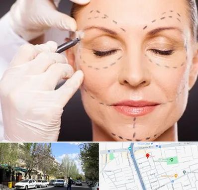 دکتر زیبایی صورت در کوی فیروز تبریز