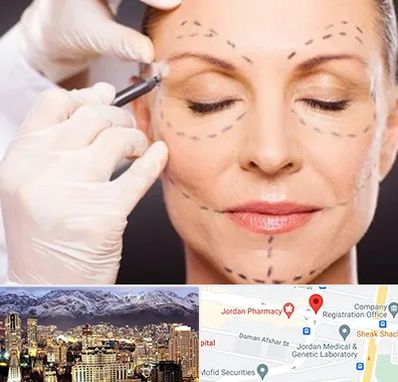 دکتر زیبایی صورت در جردن 