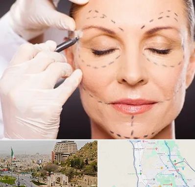 دکتر زیبایی صورت در فرهنگ شهر شیراز 