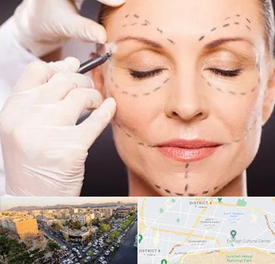 دکتر زیبایی صورت در تهرانپارس 