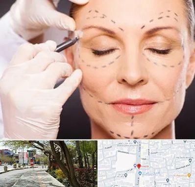 دکتر زیبایی صورت در خیابان توحید اصفهان 