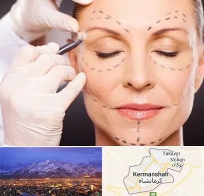 دکتر زیبایی صورت در کرمانشاه