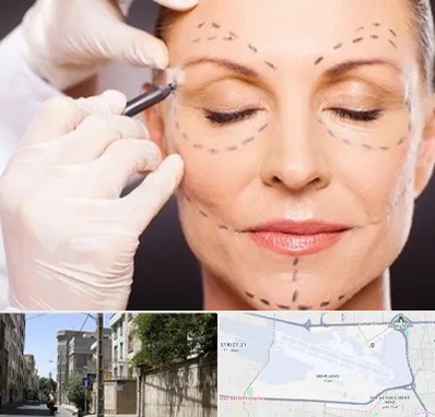 دکتر زیبایی صورت در مهرآباد