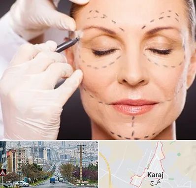 دکتر زیبایی صورت در گوهردشت کرج 