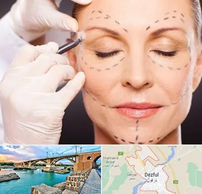 دکتر زیبایی صورت در دزفول
