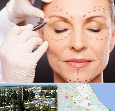 دکتر زیبایی صورت در رودسر