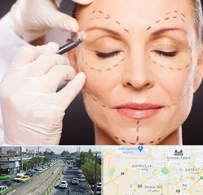 دکتر زیبایی صورت در جنوب تهران 