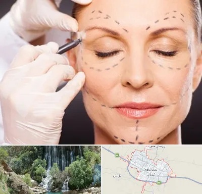 دکتر زیبایی صورت در شیروان