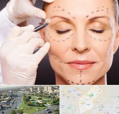 دکتر زیبایی صورت در کمال شهر کرج 