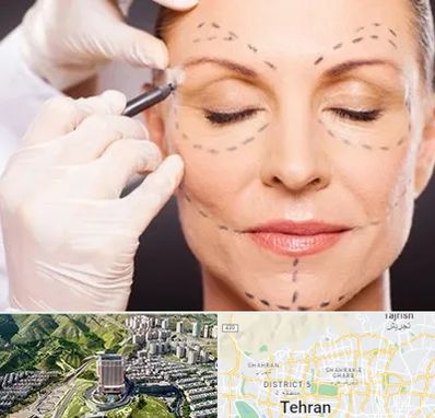 دکتر زیبایی صورت در شمال تهران 