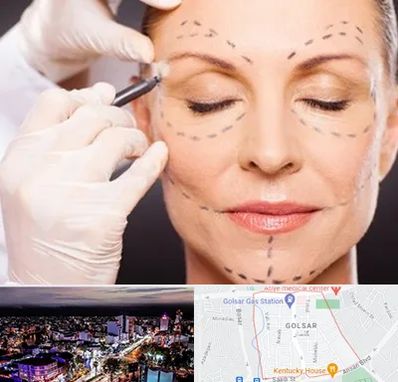 دکتر زیبایی صورت در گلسار رشت 