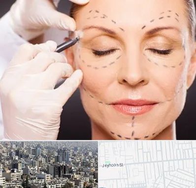 دکتر زیبایی صورت در جیحون