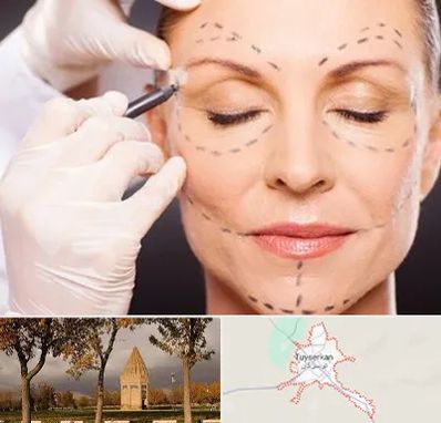 دکتر زیبایی صورت در تویسرکان