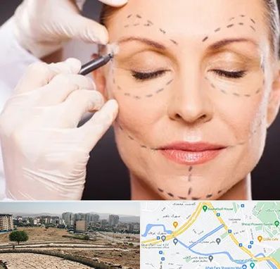 دکتر زیبایی صورت در کوی وحدت شیراز 