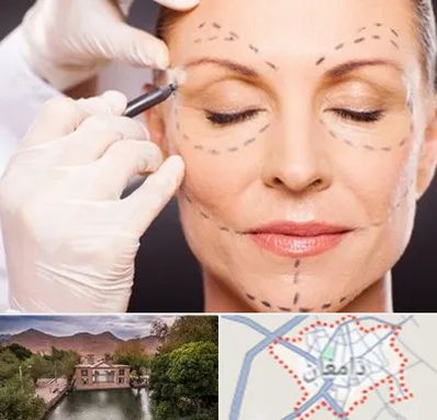 دکتر زیبایی صورت در دامغان