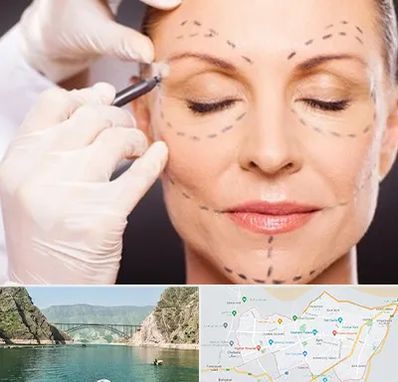 دکتر زیبایی صورت در ایلام