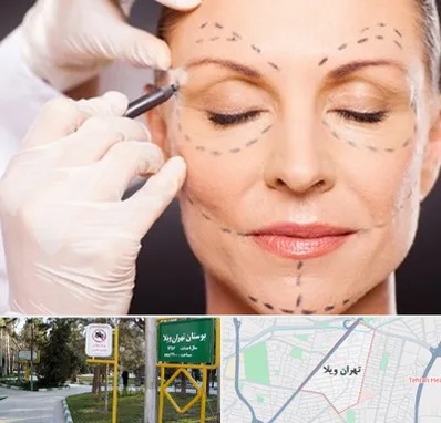 دکتر زیبایی صورت در تهران ویلا