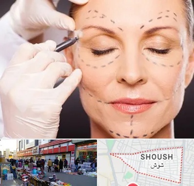 دکتر زیبایی صورت در شوش