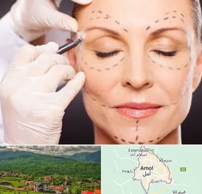 دکتر زیبایی صورت در آمل