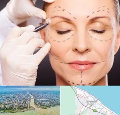 دکتر زیبایی صورت در تنکابن