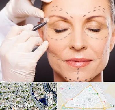 دکتر زیبایی صورت در قاسم آباد مشهد 