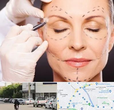 دکتر زیبایی صورت در قدوسی شرقی شیراز 